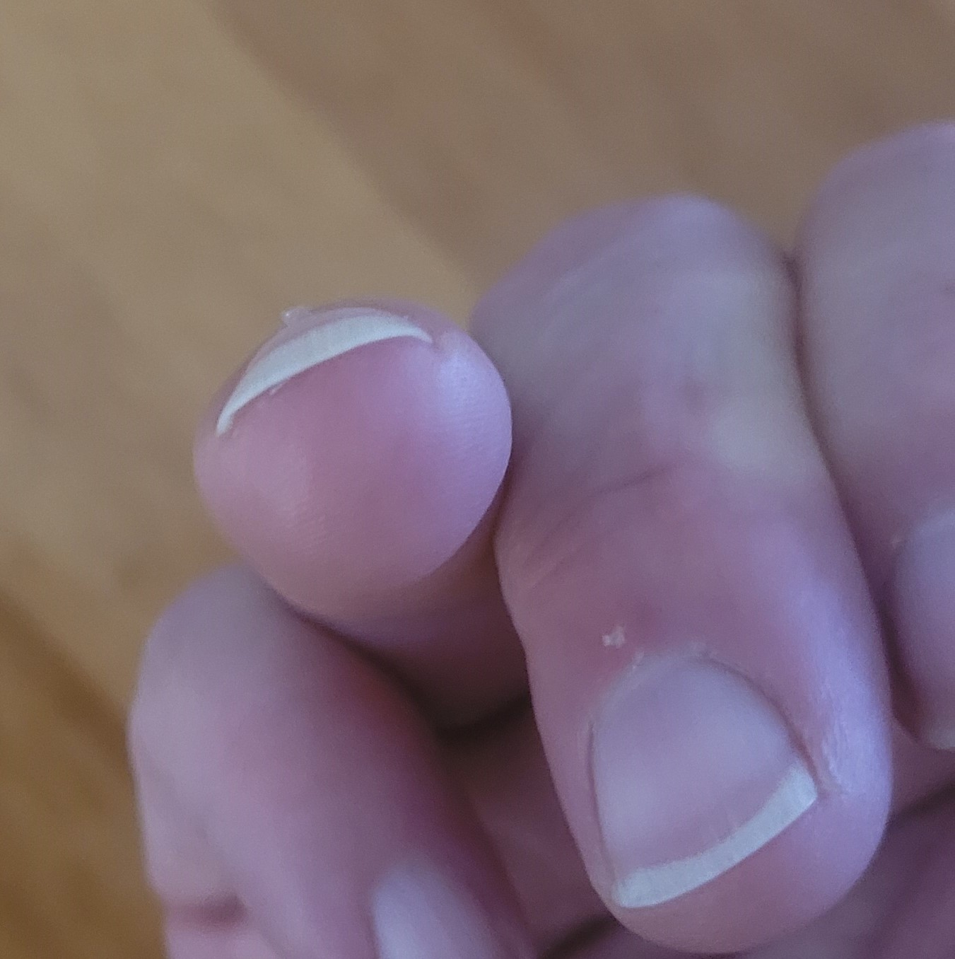 קמיצה תפיחחות וקשת